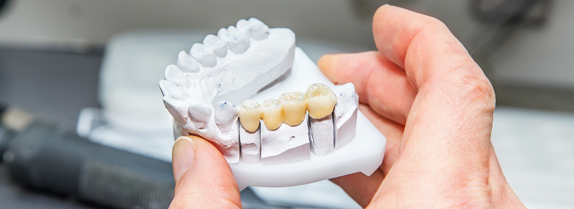 Divine Smiles Dental | Digital Impressions, Ceramic Crowns and Extractions